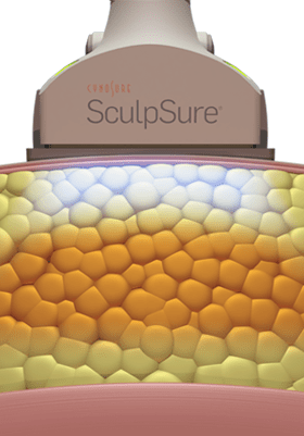 Destroying Fat Cells | SculpSure